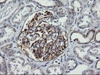 Immunohistochemistry: VTI1A Antibody (OTI1F4) [NBP2-45413]