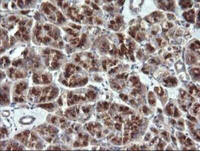 Immunohistochemistry: VTI1A Antibody (OTI1F4) [NBP2-45413]