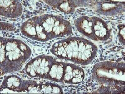 Immunohistochemistry: VTI1A Antibody (OTI1F4) - Azide and BSA Free [NBP2-74862]