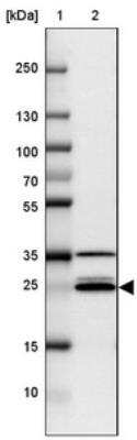 Western Blot: VTI1A Antibody [NBP2-30952]