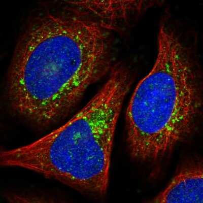 Immunocytochemistry/ Immunofluorescence: VTI1B Antibody [NBP2-33414]