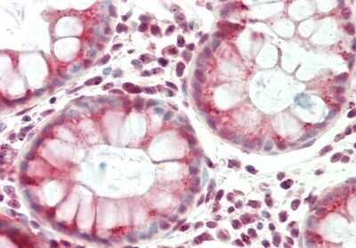 Immunohistochemistry-Paraffin: VTI1B Antibody [NBP1-79902]