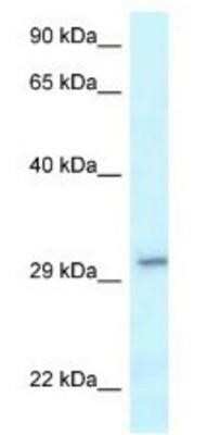 Western Blot: VTI1B Antibody [NBP1-79902]