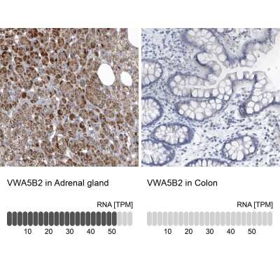 Immunohistochemistry-Paraffin: VWA5B2 Antibody [NBP2-38334]