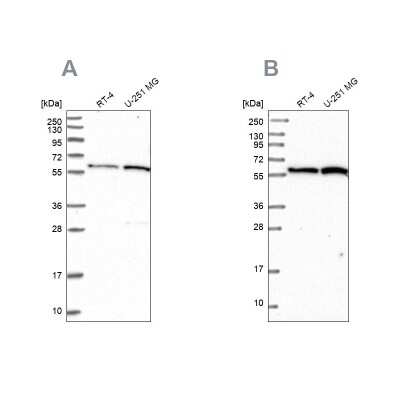 Western Blot: VWA9 Antibody [NBP1-90525]