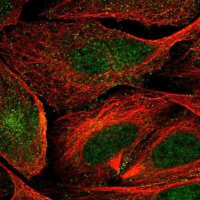 Immunocytochemistry/ Immunofluorescence: VWCE Antibody [NBP2-30467]
