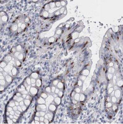 Immunohistochemistry-Paraffin: VWDE Antibody [NBP2-30605]