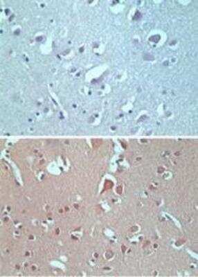 Immunohistochemistry-Paraffin: Vang-like Protein 2/VANGL2 Antibody [NBP2-24704]