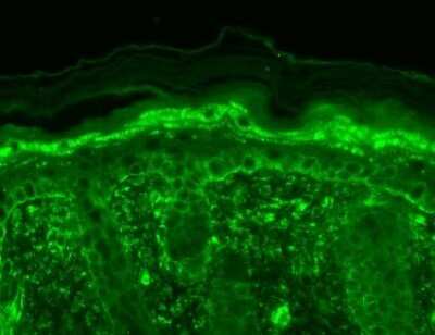 Immunohistochemistry: Vanilloid R-like 3/TRPV3 Antibody (N15/39) [NBP2-12918]