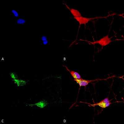 Immunocytochemistry/ Immunofluorescence: Vanilloid R-like 3/TRPV3 Antibody (S15/4) [NBP2-12909]