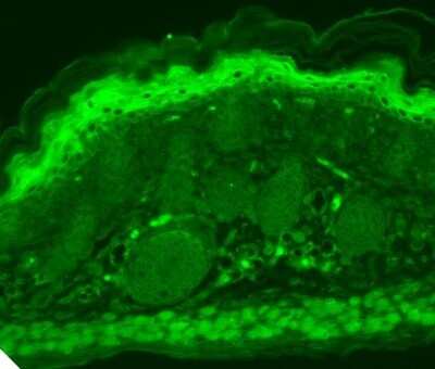 Immunohistochemistry: Vanilloid R-like 3/TRPV3 Antibody (S15/4) [NBP2-12909]