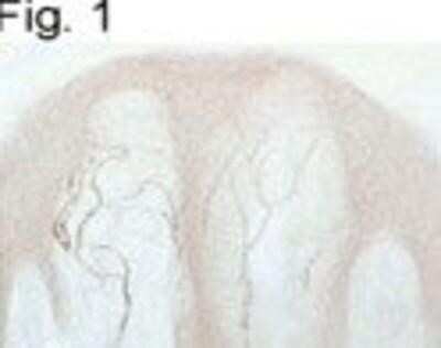 Immunohistochemistry-Frozen: Vanilloid R1/TRPV1 Antibody [NB120-3487]