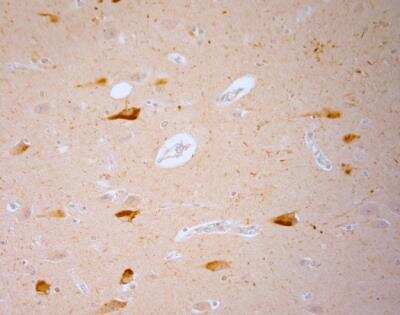 Immunohistochemistry-Paraffin: Vanilloid R1/TRPV1 Antibody [NB100-98886]