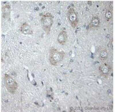 Immunohistochemistry-Paraffin: Vanilloid R1/TRPV1 Antibody [NB100-98897]