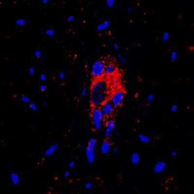 Immunohistochemistry-Paraffin: Vanilloid R1/TRPV1 Antibody - BSA Free [NBP1-71774]