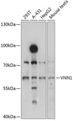 Western Blot: Vanin-1/VNN1 AntibodyAzide and BSA Free [NBP2-94850]