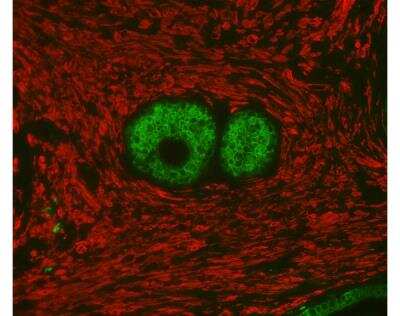 Immunofluorescence: VectaFluor(TM) Duet DL594 DL488 Labeling Kit [DK-8818-NB]