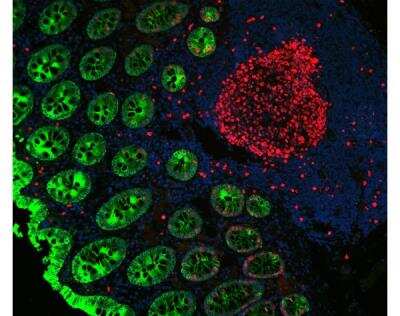 Immunofluorescence: VectaFluor(TM) Duet DL594 DL488 Labeling Kit [DK-8828-NB]
