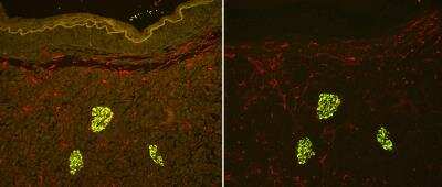 Immunohistochemistry: Vector(R) TrueVIEW(TM) Autofluorescence Quenching Kit [SP-8400-NB]