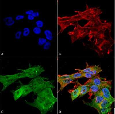 Immunocytochemistry/ Immunofluorescence: Versican Antibody (S351-23) [NBP2-22408]