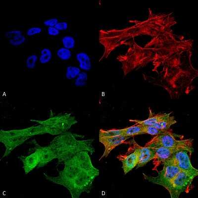 Immunocytochemistry/ Immunofluorescence: Versican Antibody (S351-23) [NBP2-22408]