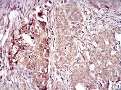 Immunohistochemistry-Paraffin: Villin 1 Antibody (3E5G11) - BSA Free [NBP2-52585]