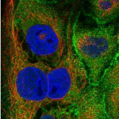 Immunocytochemistry/ Immunofluorescence: Villin 1 Antibody [NBP1-85336]