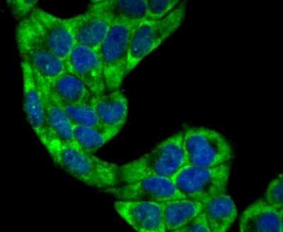 Immunocytochemistry/ Immunofluorescence: Villin 1 Antibody (JU34-75) [NBP2-75707]