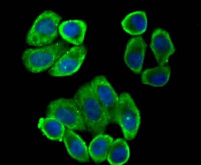 Immunocytochemistry/ Immunofluorescence: Villin 1 Antibody (JU34-75) [NBP2-75707]