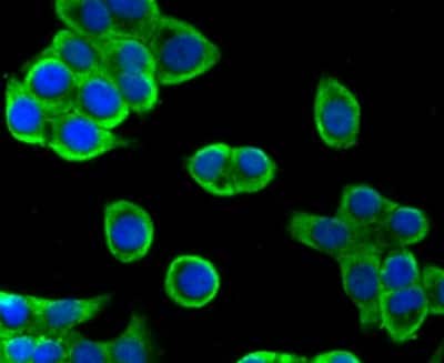 Immunocytochemistry/ Immunofluorescence: Villin 1 Antibody (JU34-75) [NBP2-75707]