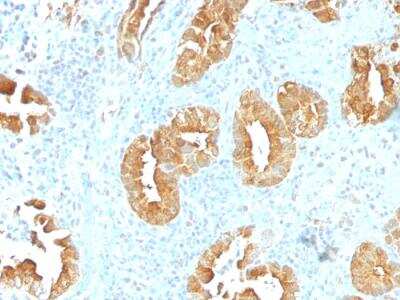 Immunohistochemistry-Paraffin: Villin 1 Antibody (VIL1/1314) - Azide and BSA Free [NBP2-50081]