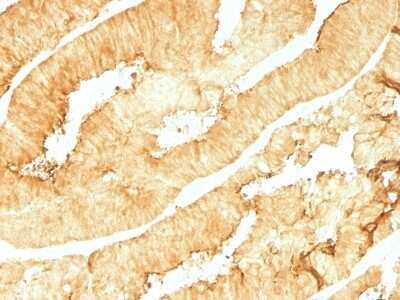 Immunohistochemistry-Paraffin: Villin 1 Antibody (VIL1/1314) [NBP2-53195]