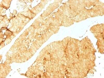 Immunohistochemistry-Paraffin: Villin 1 Antibody (VIL1/1325) - Azide and BSA Free [NBP2-54515]
