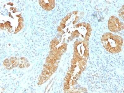 Immunohistochemistry-Paraffin: Villin 1 Antibody (VIL1/1325) - Azide and BSA Free [NBP2-54515]