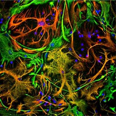 Immunocytochemistry/ Immunofluorescence: Vimentin Antibody (2A52) [NBP1-92688]
