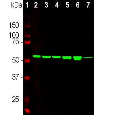 Western Blot: Vimentin Antibody (2A52) [NBP1-92688]