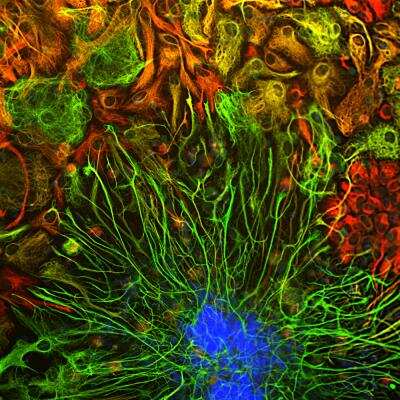 Immunocytochemistry/ Immunofluorescence: Vimentin Antibody (2D1) [NBP1-92687]