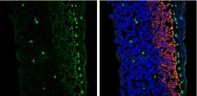 Immunohistochemistry-Frozen: Vimentin Antibody (812) [NBP2-43560]