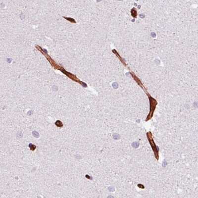 Immunohistochemistry-Paraffin: Vimentin Antibody (CL0157) [NBP2-52867]
