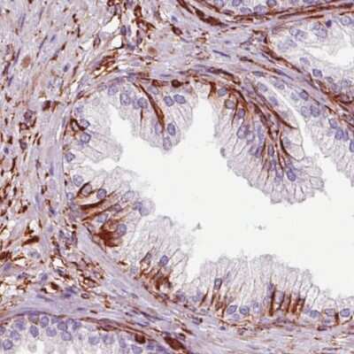 Immunohistochemistry-Paraffin: Vimentin Antibody (CL0157) [NBP2-52867]