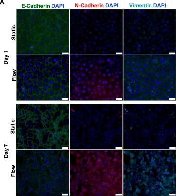 Immunocytochemistry/ Immunofluorescence: Vimentin Antibody [NB300-223]