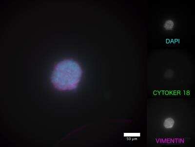 Immunocytochemistry/ Immunofluorescence: Vimentin Antibody [NBP1-31327]