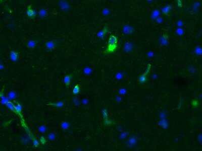 Immunohistochemistry-Frozen: Vimentin Antibody [NB300-223]