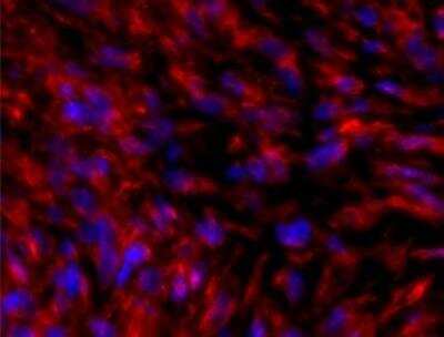 Immunohistochemistry-Frozen: Vimentin Antibody [NB300-223]