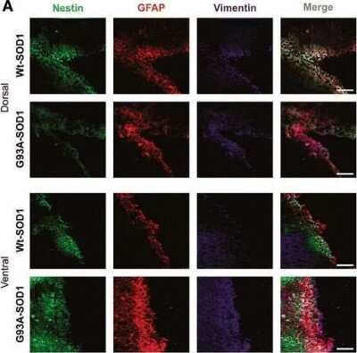 Immunohistochemistry: Vimentin Antibody [NB300-223]