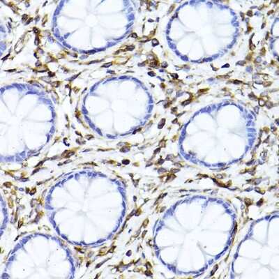 Immunohistochemistry-Paraffin: Vimentin Antibody - Azide and BSA Free [NBP3-03221]