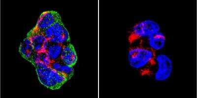 Immunocytochemistry/ Immunofluorescence: Vimentin Antibody (J144) [NB100-74564]