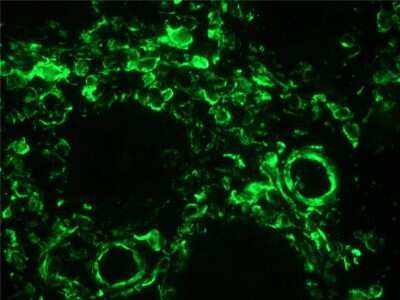 Immunohistochemistry-Frozen: Vimentin Antibody (RV202) - BSA Free [NBP1-97672]