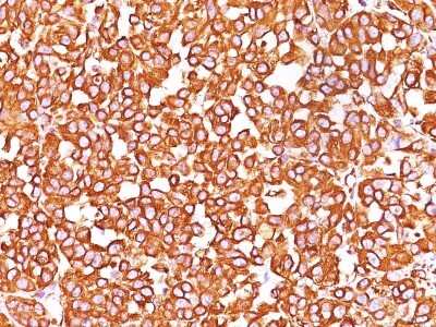 Immunohistochemistry-Paraffin: Vimentin Antibody (SPM576) - Azide and BSA Free [NBP2-34809]