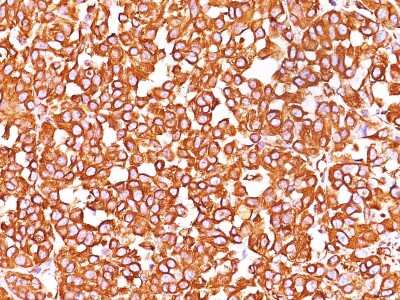 Immunohistochemistry-Paraffin: Vimentin Antibody (SPM576) [NBP2-32910]